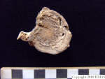 L_V20d5093 A16.54 R827 lR at herniated vertebra superior view.JPG L_V20d5093 A16.54 R827 lR at herniated vertebra superior view